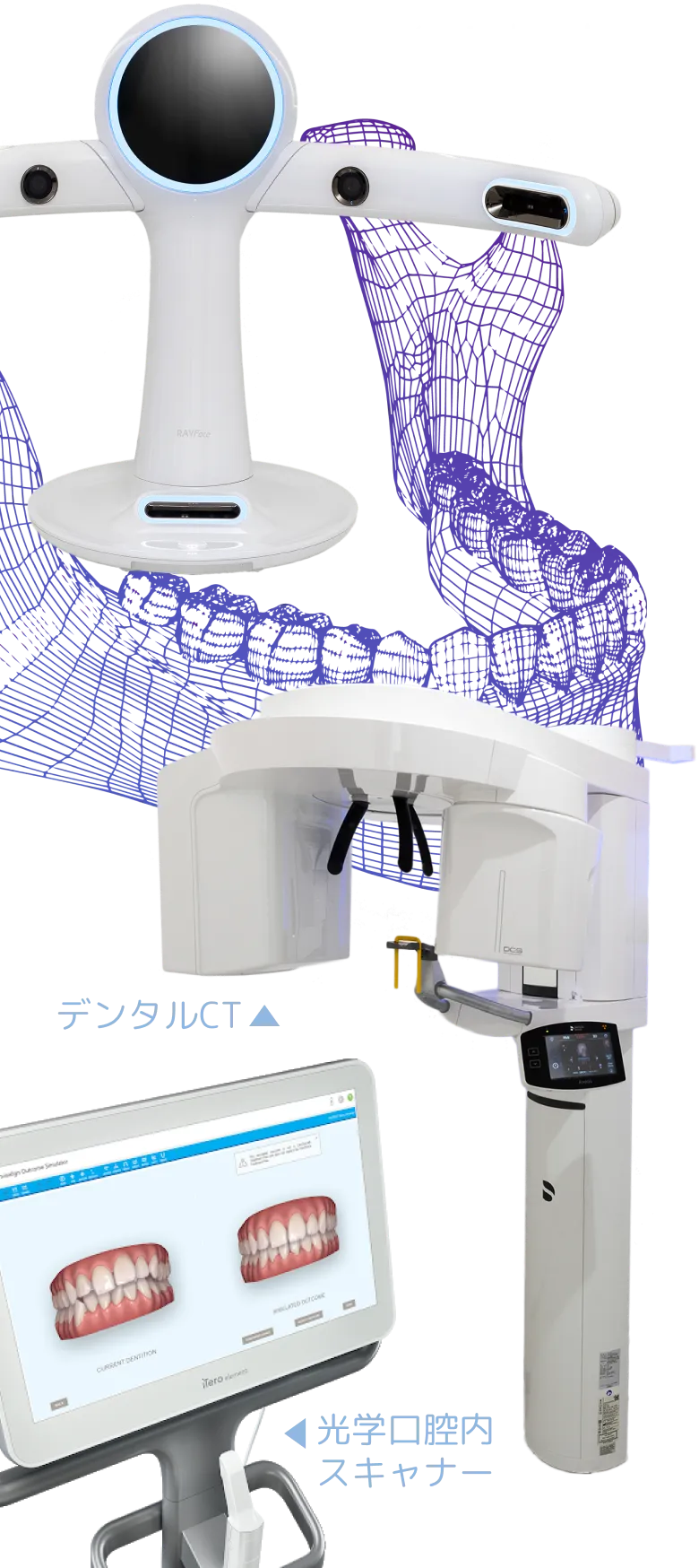 デジタル技術を使ったマウスピースの設計・製作